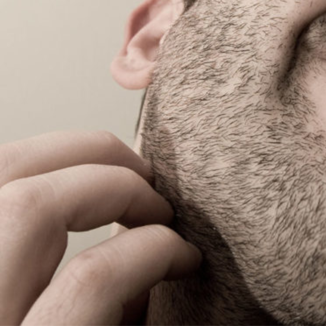 Come alleviare il prurito della barba Bulligans